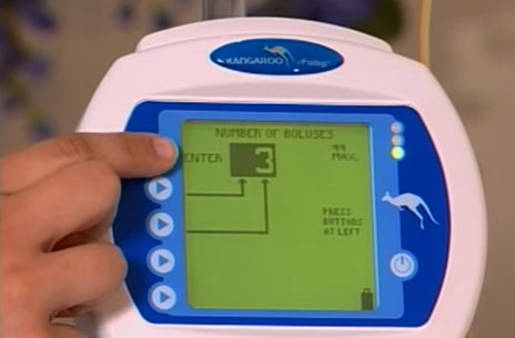 Video: Kangaroo ePump in service | Siamed SA